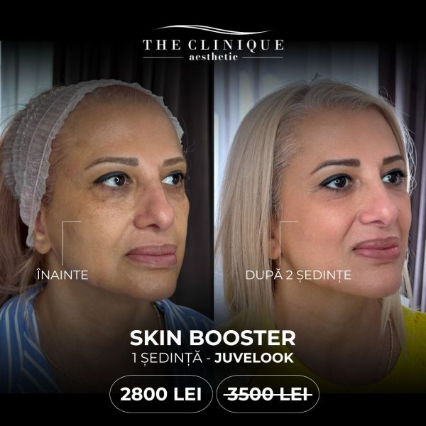 Skin Booster - 1 ședință JUVELOOK