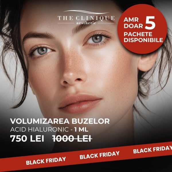 Volumizarea Buzelor Acid Hialuronic - 1ml