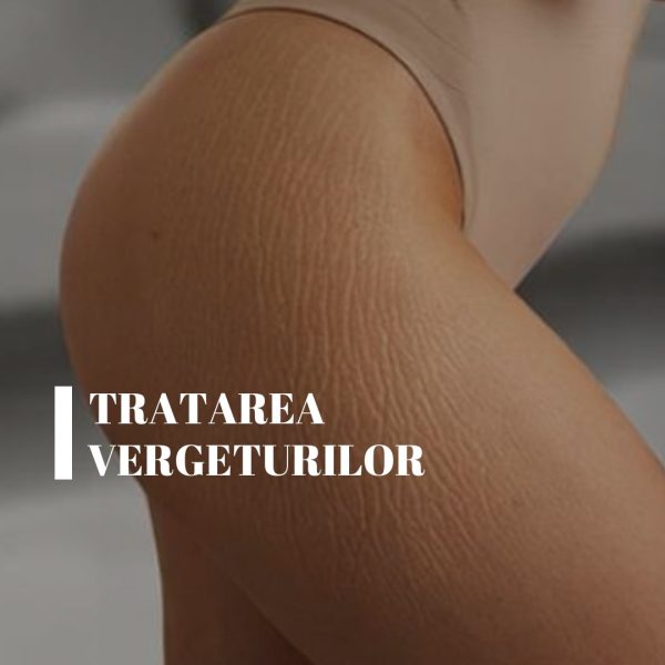 Tratarea Vergeturilor