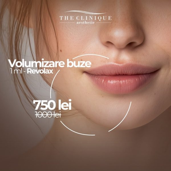 Volumizare buze 1ml Revolax