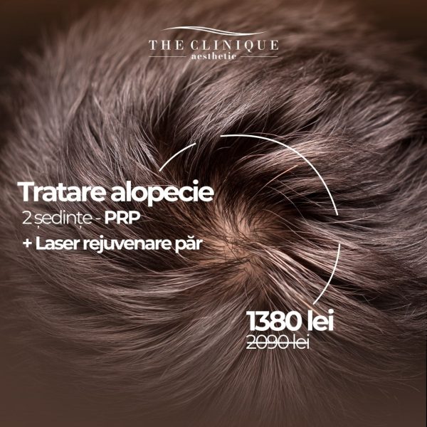 Tratare alopecie 2 ședințe PRP + laser rejuvenare păr