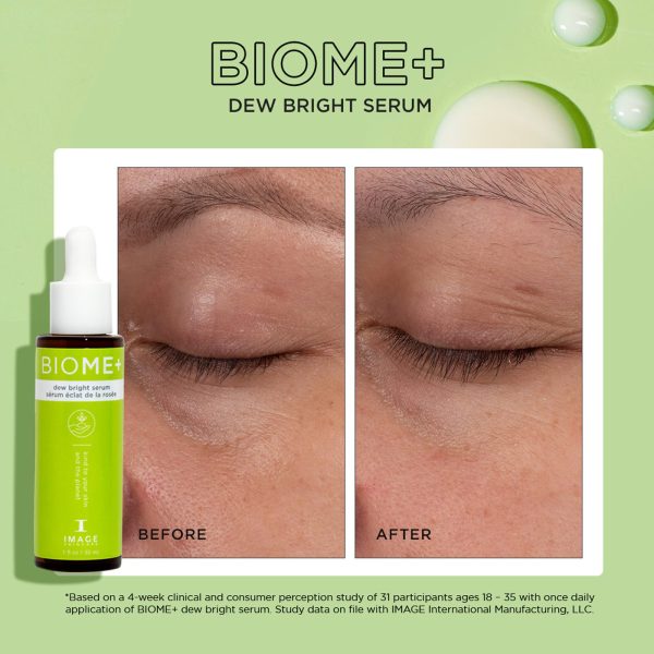 Ser luminozitate Image BIOME+ Dew Bright Serum - imagine 2