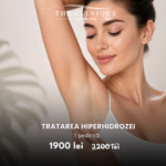 Botox Hiperhidroză (Transpirație Excesivă)