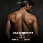 Epilare definitiva la sedinta pentru barbati