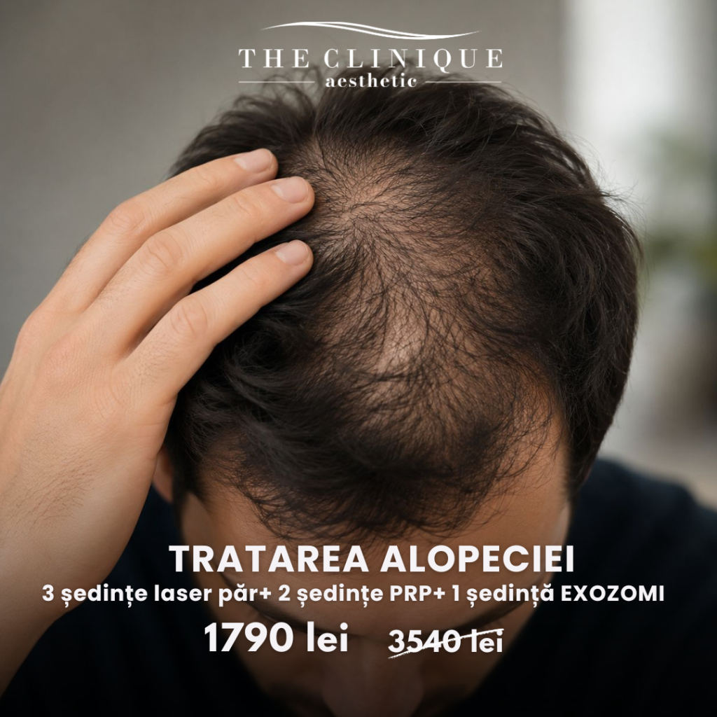 Tratare Alopecie PRP