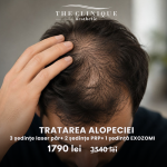 Tratare Alopecie PRP