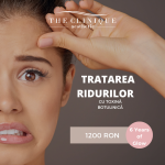 Tratarea Ridurilor cu Botox - 3 Zone