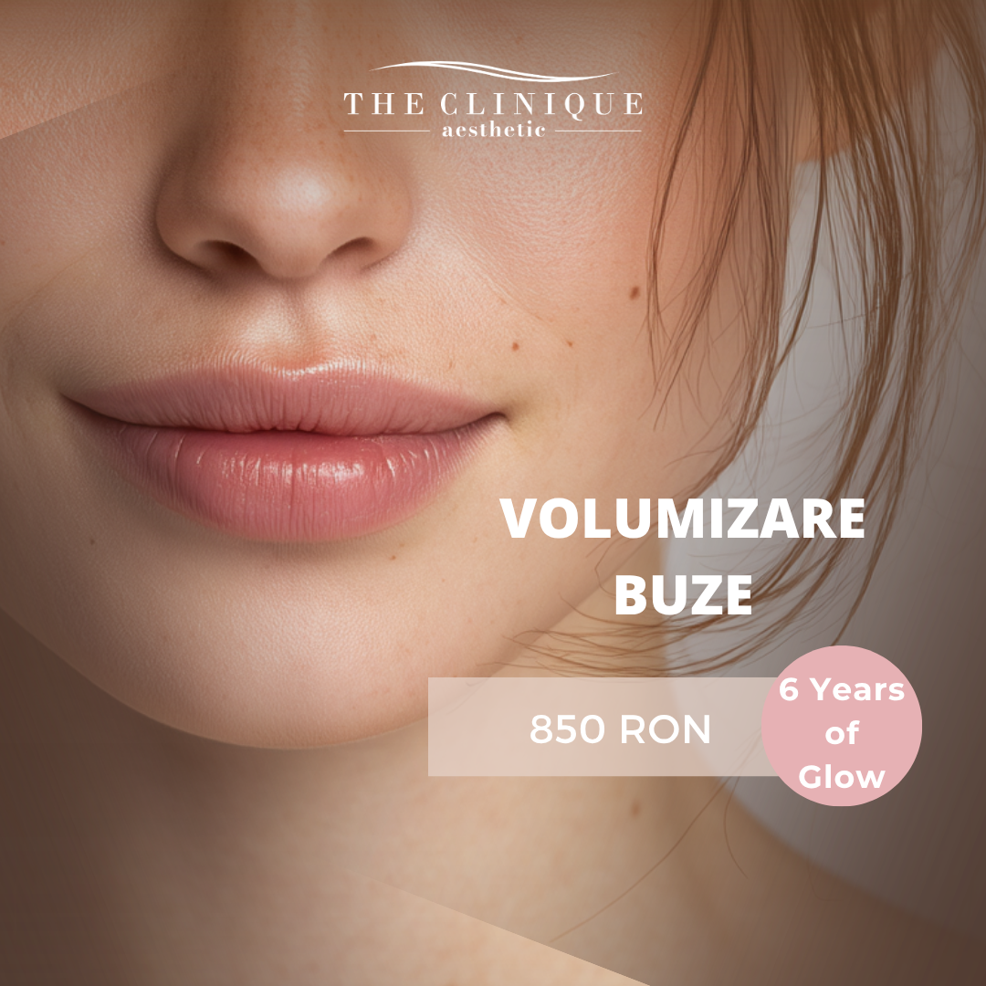 acid hialuronic (1) Volumizare Buze - 1ml Revolax - imagine 1