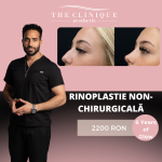 Barbie Nose cu Rinoplastie Non-Chirurgicală